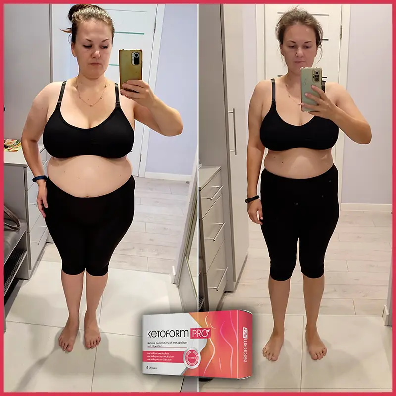 KetoForm Pro отзыв 1
