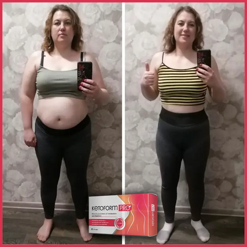KetoForm Pro отзыв 3