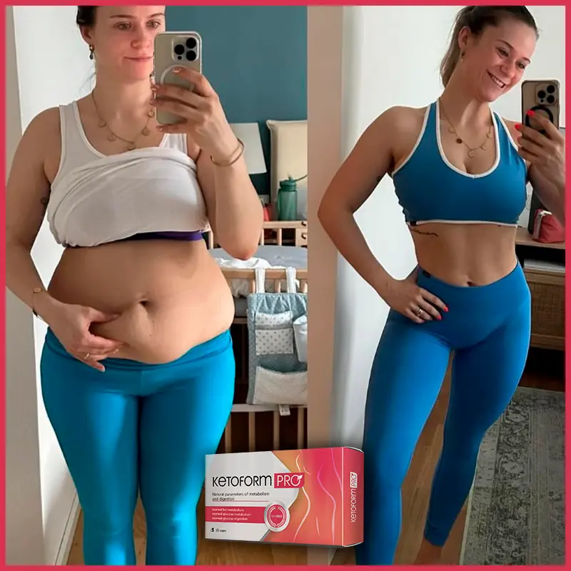 KetoForm Pro отзыв 4