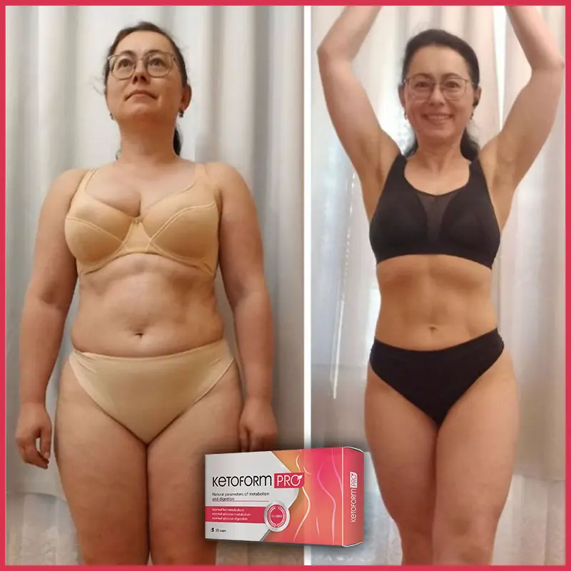 KetoForm Pro отзыв 8