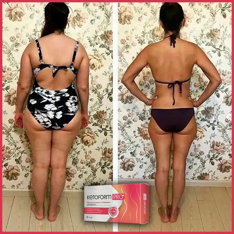 KetoForm Pro отзыв 10